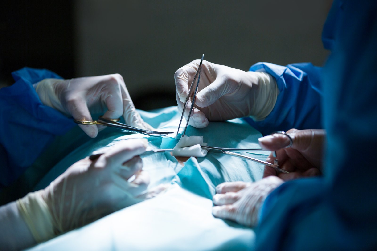 GENERAL SURGERY