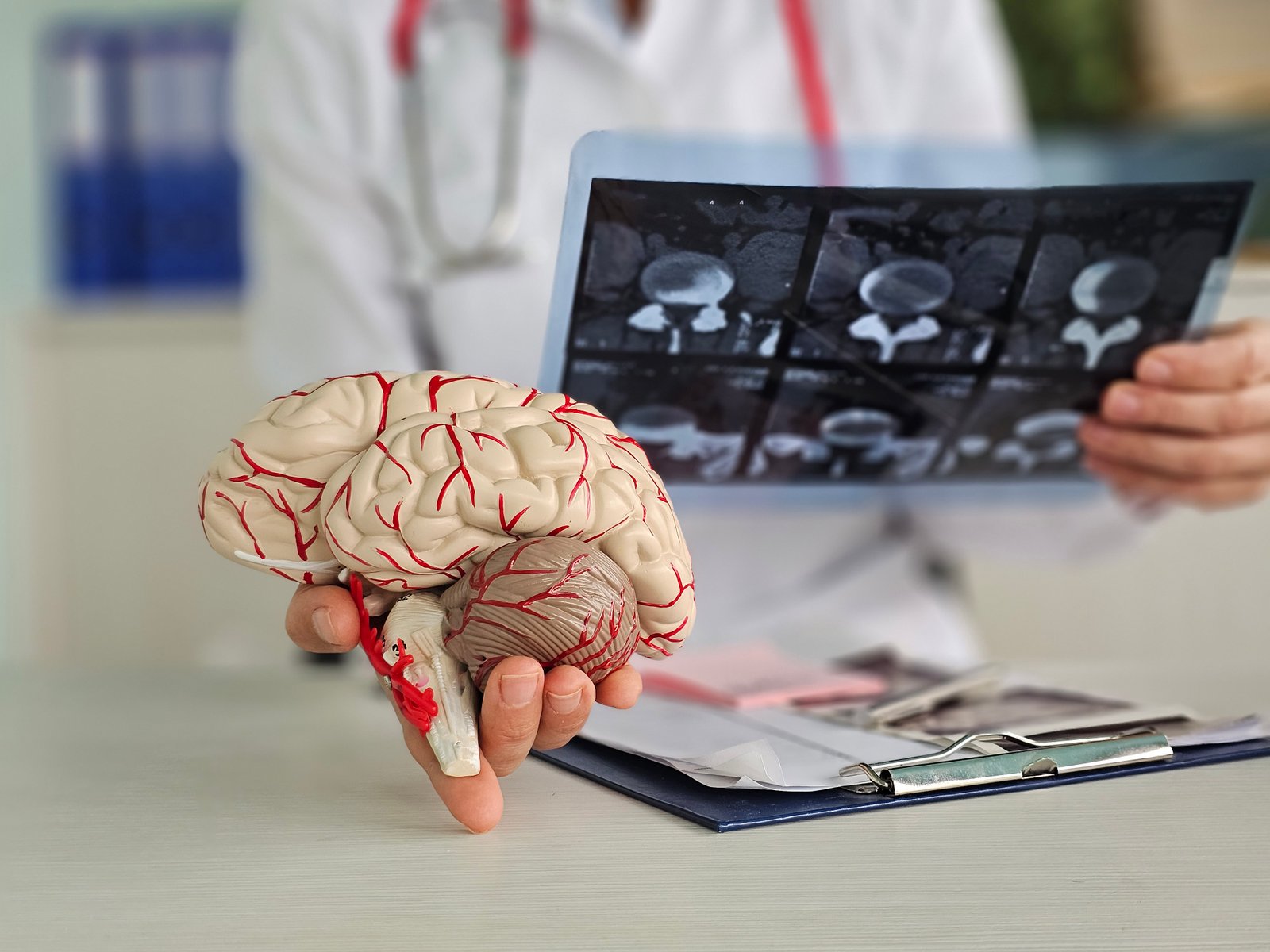 Neurology